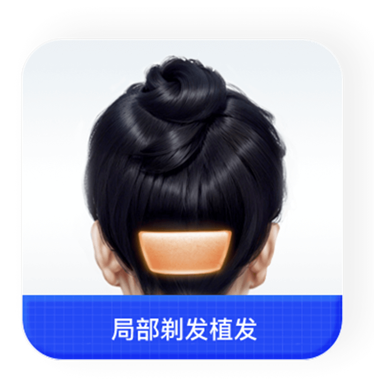 局部剃发植发背面说明