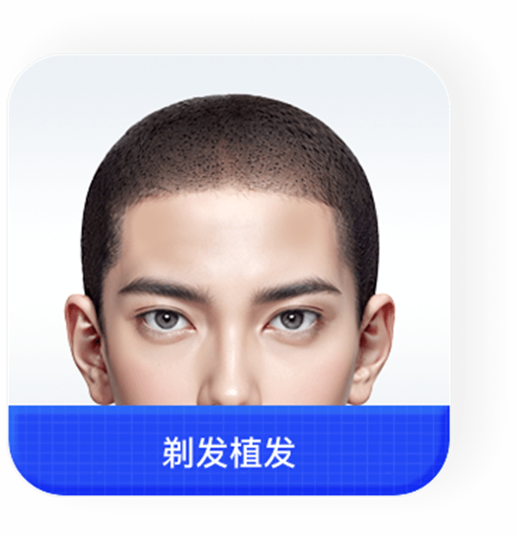 剃发植发背面说明